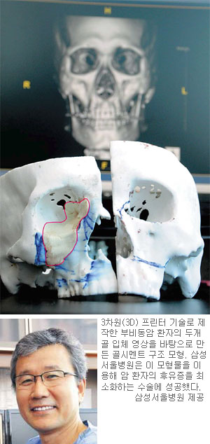 ³î¶ó¿î ¡®3D ÇÁ¸°ÅÍ¡¯¡¦ ¾Ï ¼ö¼úµµ ÇØ³Â´Ù ±â»çÀÇ »çÁø