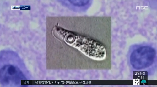 미국 루이지애나 수돗물서 '뇌 먹는 아메바' 또 검출…한국에선? 기사의 사진