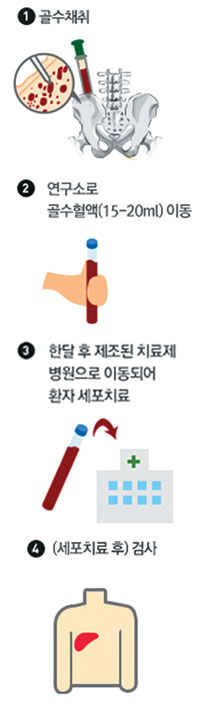 굳어진 ‘간’ 줄기세포로 고친다 기사의 사진