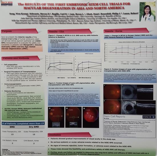 배아줄기세포로 난치성  실명 질환 치료, 한·미 임상시험 성과 국제학술대회서 주목 기사의 사진