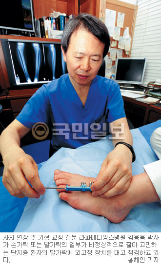 뭉툭한 손·발가락… 5㎝까지 늘린다  