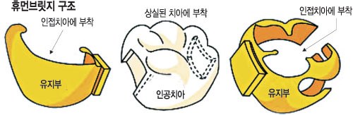 롤 ޸պ긴 ƽó  