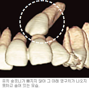 츮  ġ    µ ?  