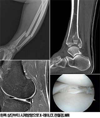 ٸ ƴµ X- , MRI   