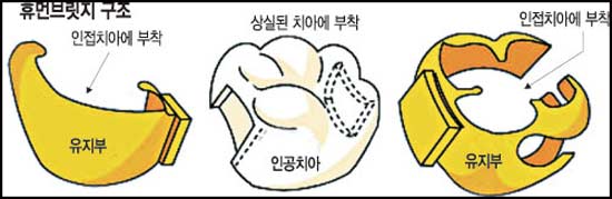 öƮ  ޸պ긴 ?  