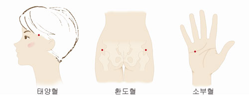  D-100,  ǰй  