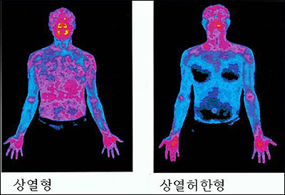 “이명환자 15%, 머리 울리는 ‘두명’ 동반”  