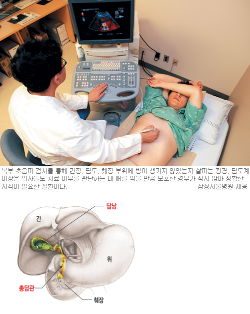 담낭 “벽 괜찮으면 겁먹지 마세요”  