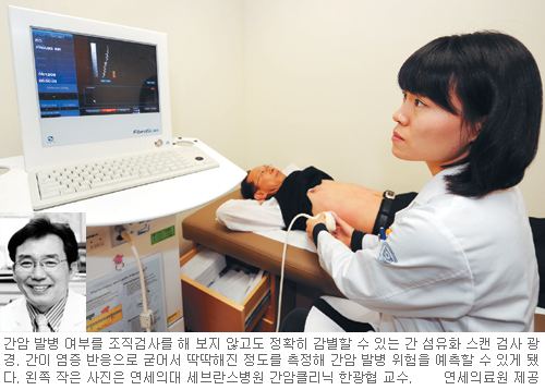조직검사 안해도 간암발병 알수있다… 초음파 적용 ‘간 섬유화 스캔 검사’  