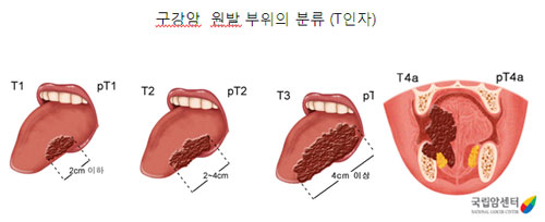 [ ̷ غ(12)-]  쿡  ǽؾ ϳ?  