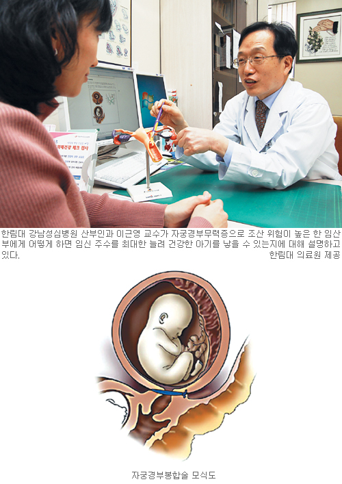 [건강한 임신과 출산] ‘20분에 4번·60분에 8번’ 자궁 수축 이상땐 조산 의심！  