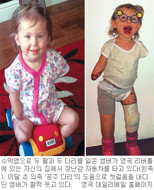 팔·다리 잃은 두살배기 앰버 기적의 첫걸음  