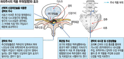  ġ 㸮 ֻ硯 3ȸ ޾ƾ  