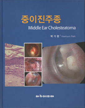 [Ű]ڱ ִ뺴 ,   å 쳻  