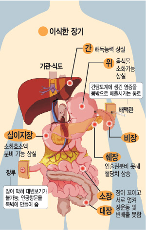 일곱 살 은서 ‘새 삶의 기적’… 햄버거 맘껏 먹고 싶다는 아이의 소망이 이뤄졌다  