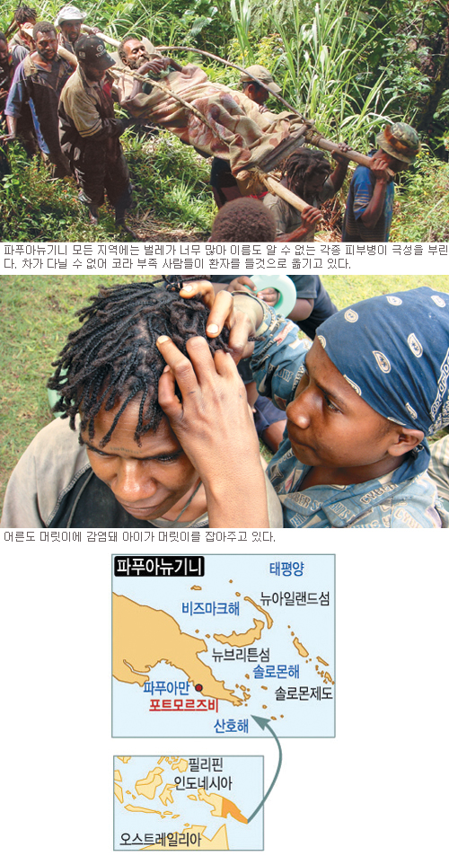 [열방우체국-파푸아뉴기니 문성 선교사] (15) 하나님이 행하셨습니다  