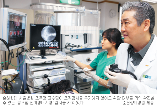 위암이 의심된다면… “공초점 현미경내시경 어때요”  