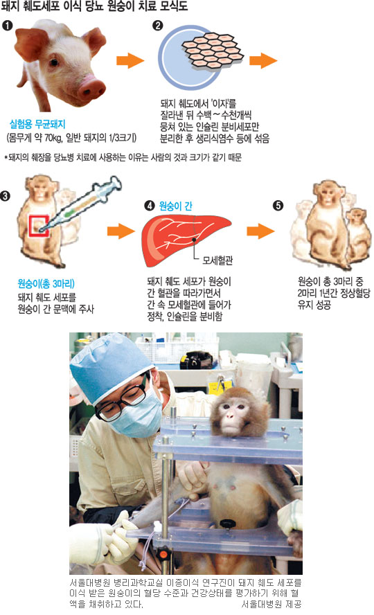 돼지 췌도 세포 이식받은 원숭이 1년째 생존… 당뇨 완치 ‘새 빛’ 2013년 사람 간 동종이식  