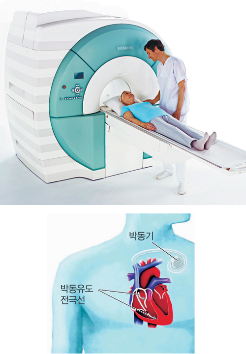 MRI 사각지대 이식형 의료기기 삽입 환자들… 이제 우리도 MRI 찍을 수 있어요  