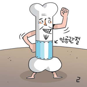 [헬스 파일] 인공관절 수술  