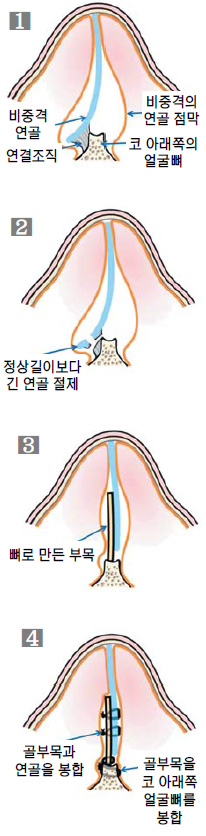   ߰ݸ  ȭ  