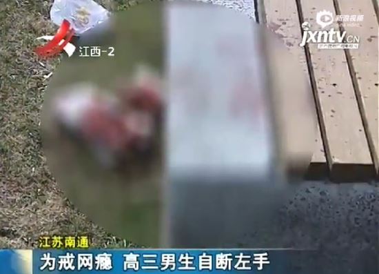 인터넷 중독 청소년 스스로 손목 절단… “중독 끊으려고”  