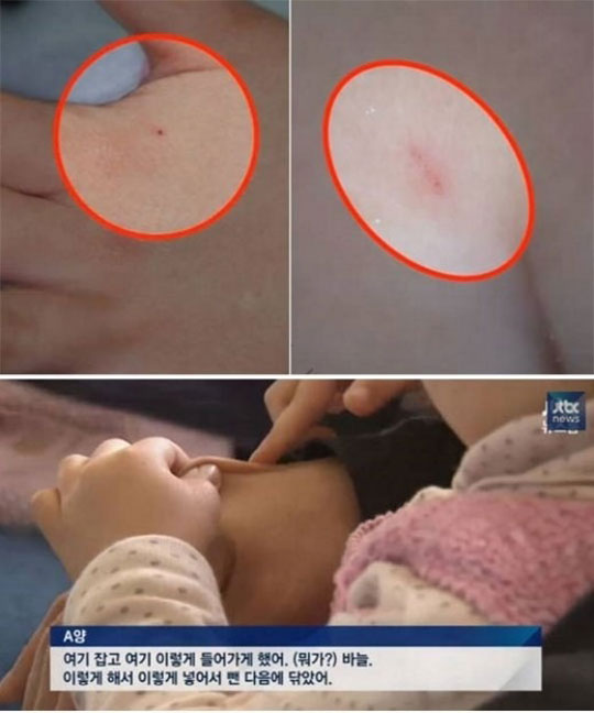 “원비 안내려고 바늘학대 자작극?” 피해아동 엄마 소문에 눈물 호소  