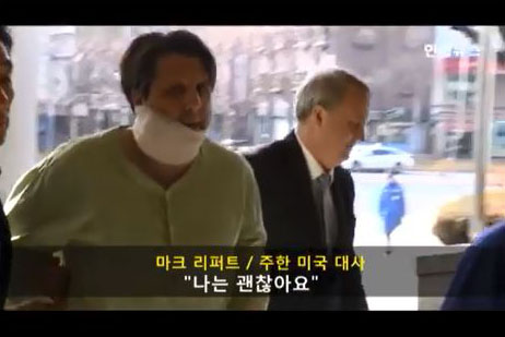 [美대사 테러] 1차 응급조치후 세브란스병원 이송 중 리퍼트 대사, “나는 괜찮아요”  