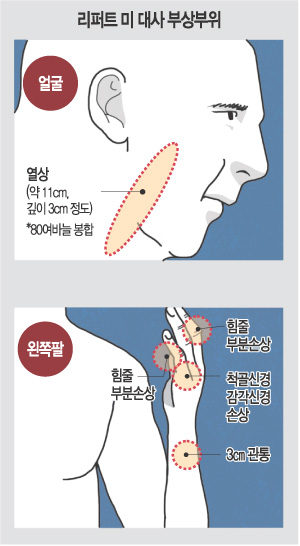 [Ʈ ڸ  ׷]  浿ơȸ Ű Ѱ ġ ߴ  