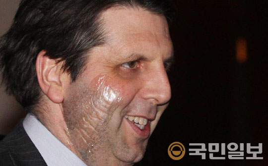 “리퍼트 대사 얼굴에 피가 이상해! 과도엔 피도 안 묻었어”… 음모론 활개  