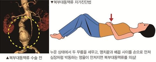  ź δ뵿Ʒ