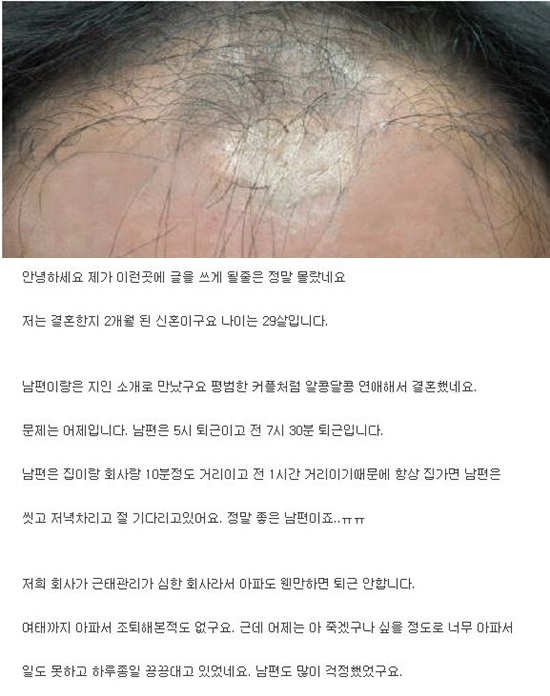 자상했던 내 남편이 ‘대머리’였다니!… 이혼하고 싶은데, 나 어떡해요?  