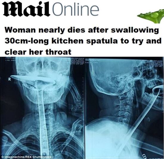  30cm ְ ־    ִ    