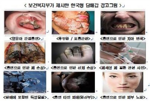 앞으로 담뱃갑에 이런 끔찍한 그림이… 관련 법안 본회의 통과  