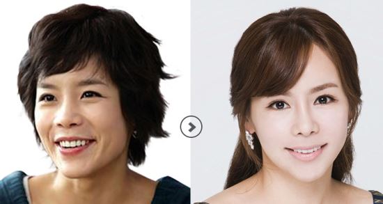 ‘의느님이 만든 얼굴’ 윤현숙 확 달라진 얼굴, 신이와 같은 병원 출신  