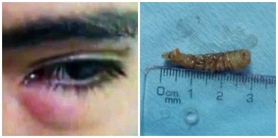 []     ôϡ  ӿ 3cm   