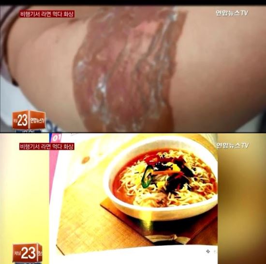 기내서 라면에 화상입은 모델출신 승객은 누구?…네티즌 궁금증 ‘폭발’  