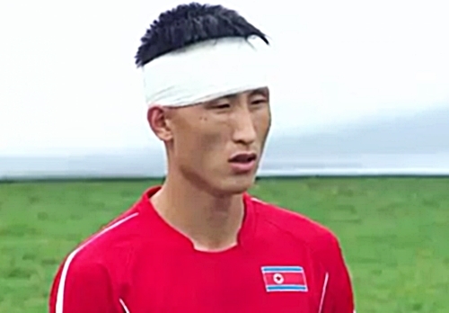 한국전 붕대 투혼 북한 장국철은 MB 닮은 ‘각하 수비수’  