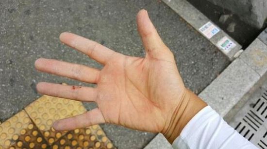서울대입구역 떨어진 벽돌 함께 치운 관악구 시민의식 ‘훈훈’  