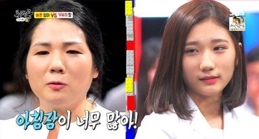 ‘동상이몽’ 너무 느린 딸, 답답해요… 알고 보니?  
