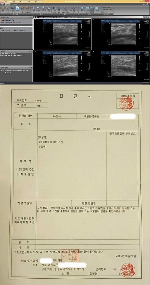 “자연산 맞죠?” 유승옥 D컵 가슴성형 의혹에 CT까지 공개  