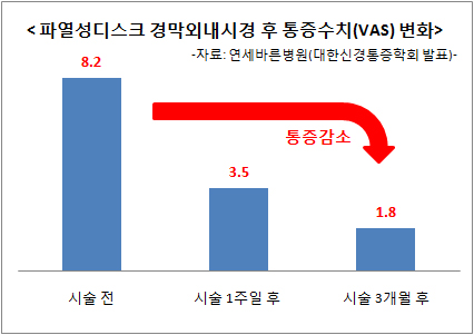 터진 허리 디스크，꼭 수술 않고도 통증 경감, 자연 치유 유도한다  