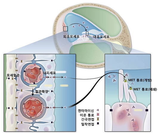 겐타미이신 항생제 남용하면 영구 청력상실 부작용 위험  
