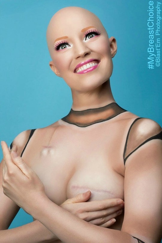 유방암수술 비포 앤 애프터… 가슴 화보 찍은 美배우 기사의 사진
