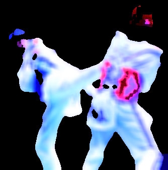 ܱ Ÿ   ݰ  ±ǵ, 󵥿 и  