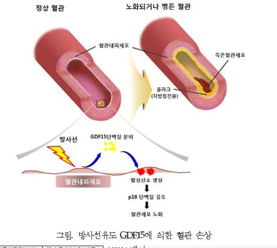 암환자 방사선 치료시 혈관 손상 이유는?  
