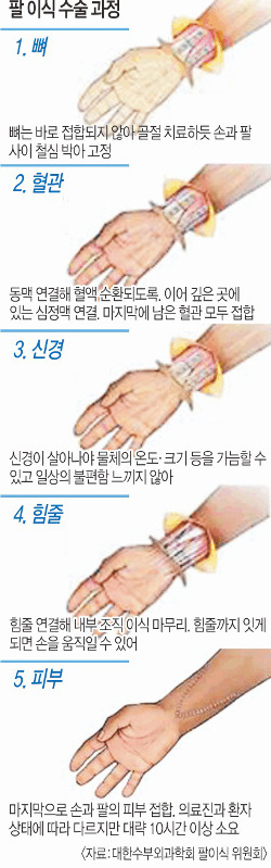 [& And ǰ] ̽ ꡯ ݾҴ  